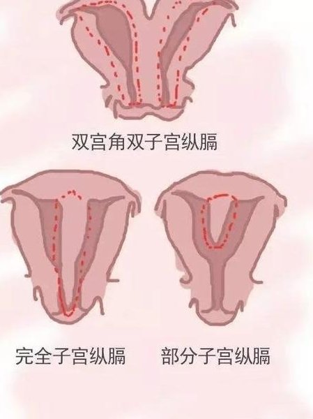 孕期四维检查比较佳时间是什么？